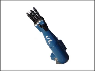 Thumbnail for Intelligente Prothese ©IRT