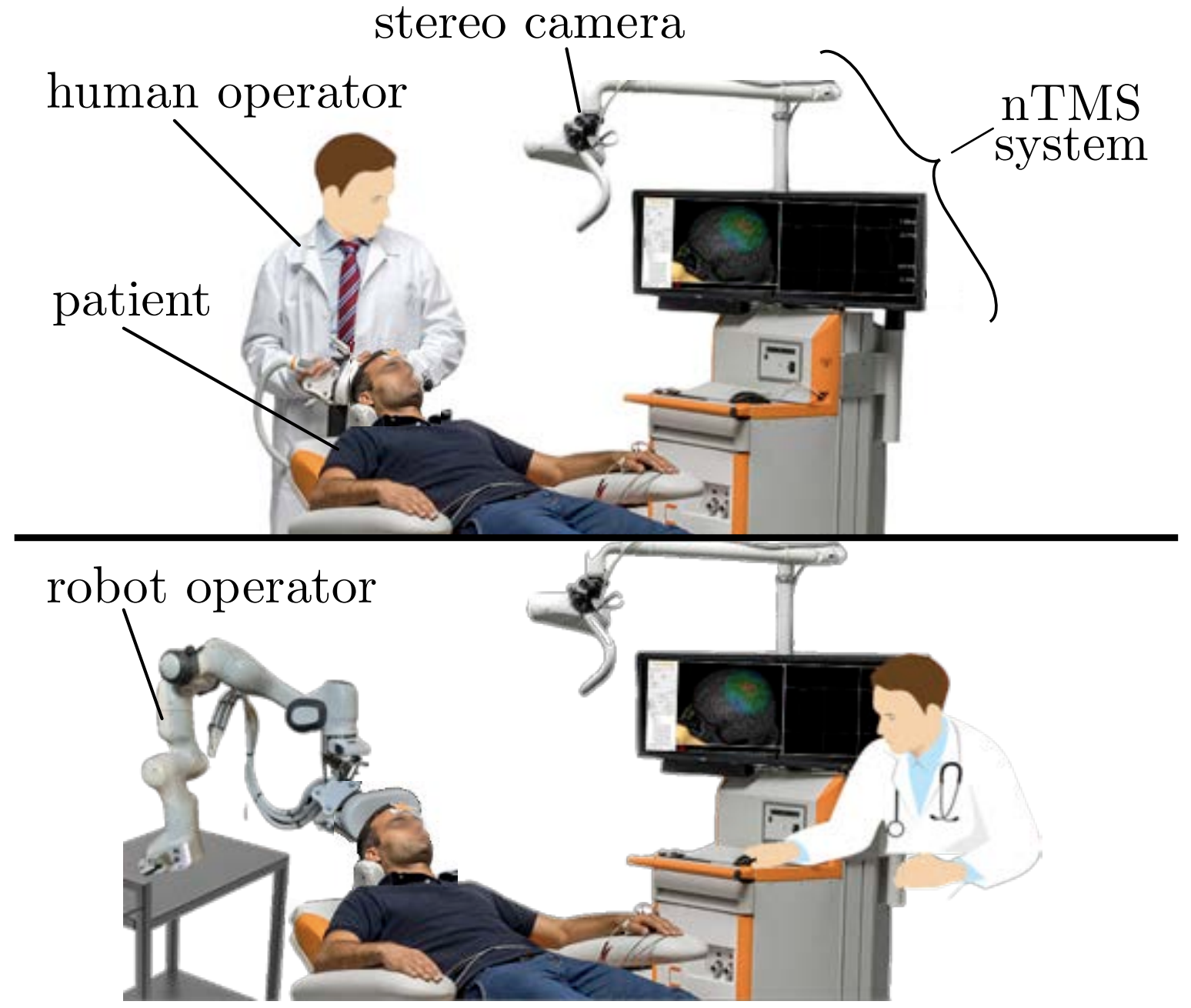 Thumbnail for Transcranial Magnetic Stimulation Robotic Assistant: towards a fully automated stimulation session